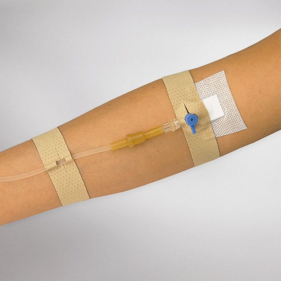 Curafix i.v. classic Kanülenfixierpflaster fixiert eine Infusionskanüle am Unterarm